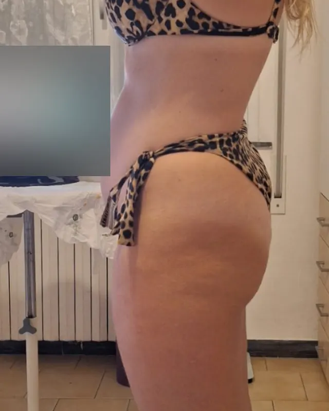 Dopo: Addome, fianchi e glutei