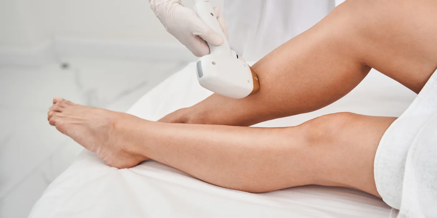 Epilazione laser sulle gambe in cabina